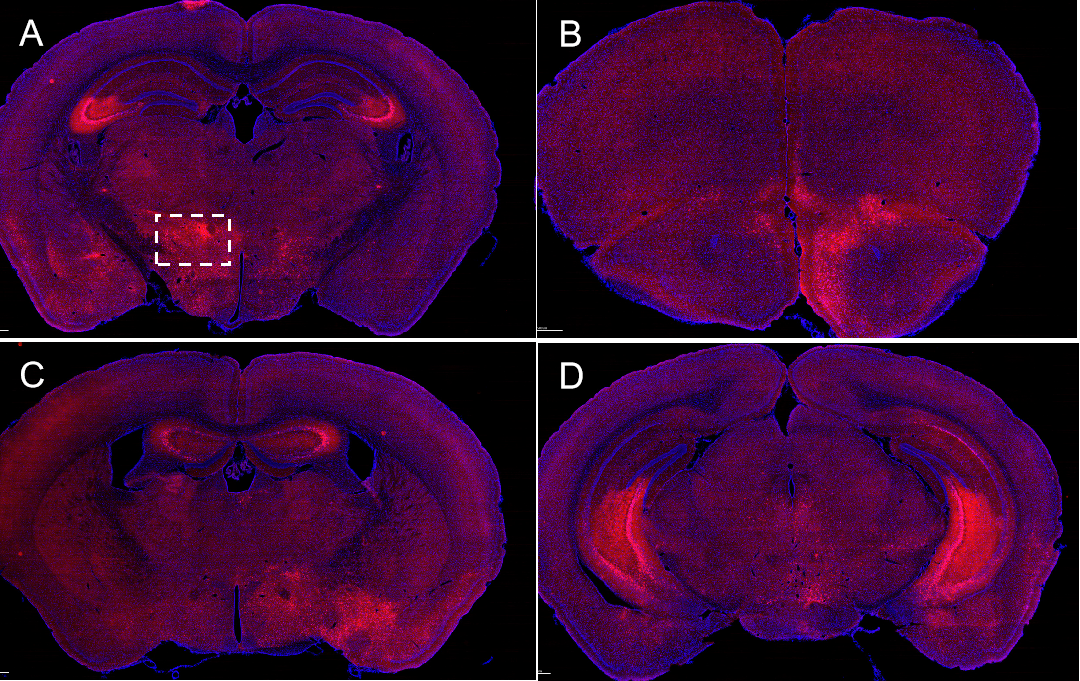 PRV-805 Grand Release! Independently Developed in China, Unlocking a New Chapter in Brain Science Research!