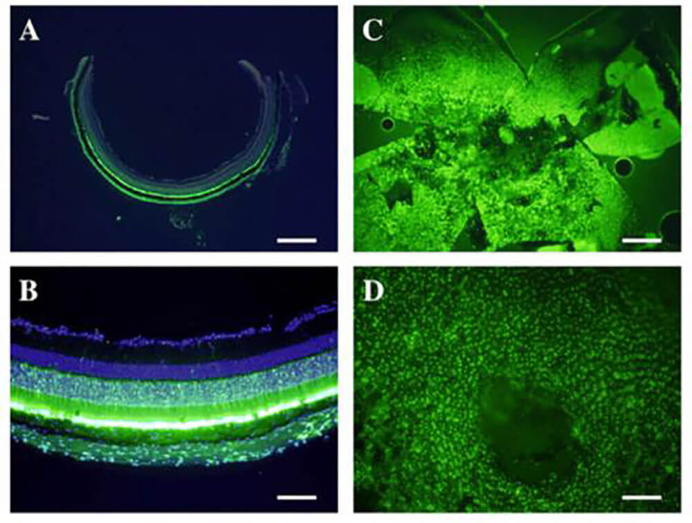 AAV Vector Production-Custom AAV-gene therapy vectors-BrainCase