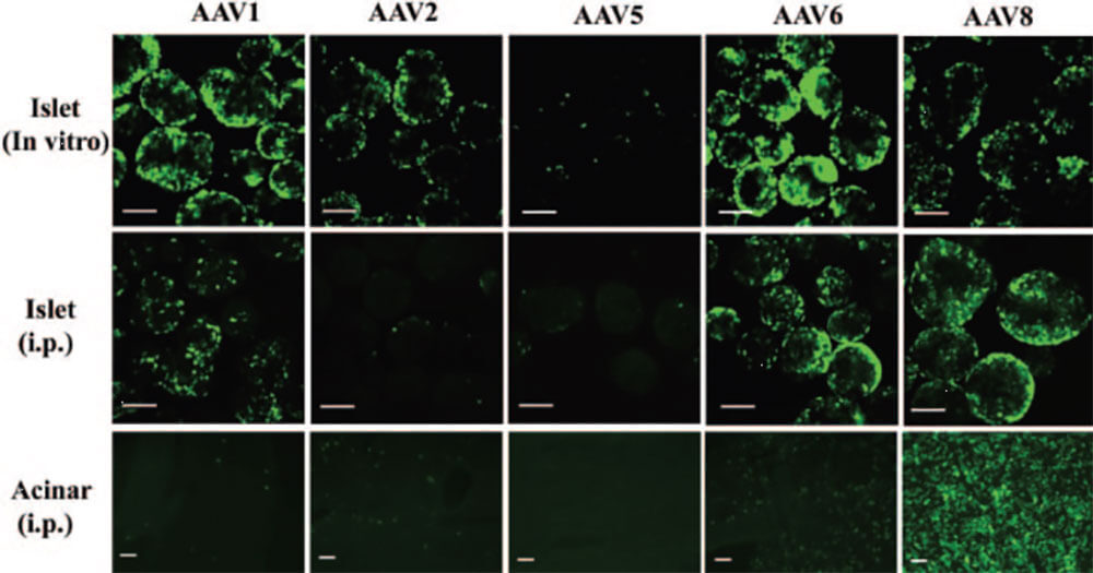 不同血清型dsAAV-CB-GFP载体对离体胰岛和体内胰腺的转导作用
