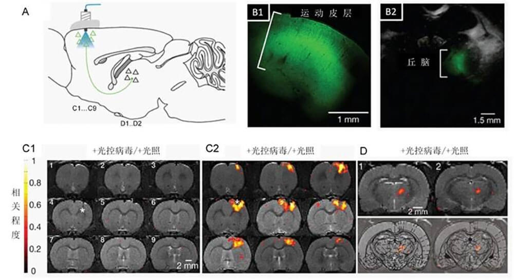 Functional Magnetic Resonance Imaging Technology