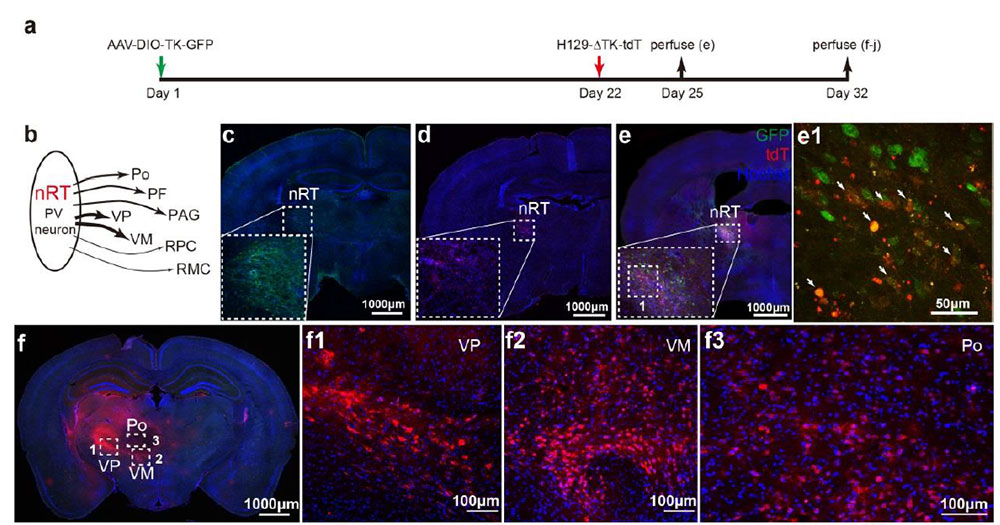 Herpes Simplex Virus Vector - gene therapy vectors - BrainCase